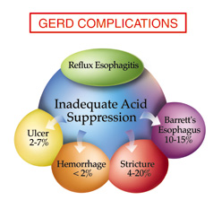 GERD complications